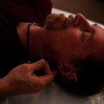 非藥物療法夯 引爆針灸與乾針大戰