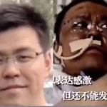 因染新冠容貌變黑的武漢醫生 搶救無效病逝